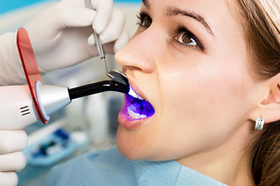 Today s Dental of Lunenburg | Dental Sealants, Dental Implants and Cosmetic Dentistry