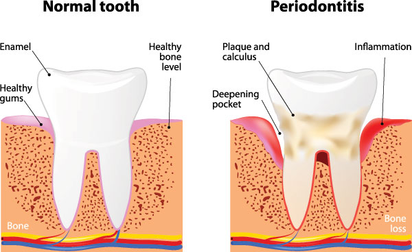 Today s Dental of Lunenburg | Cosmetic Dentistry, Pediatric Dentistry and Drill Free Dentistry