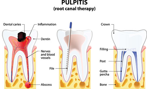 Today s Dental of Lunenburg | Cosmetic Dentistry, Dental Veneers and Night Guards for TMJ